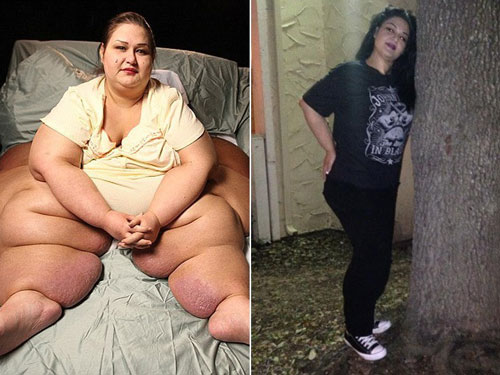 Самая толстая женщина в мире сбросила 80% веса