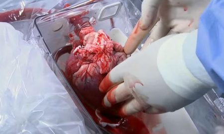 Ученые почти готовы к пересадке человеку свиного сердца