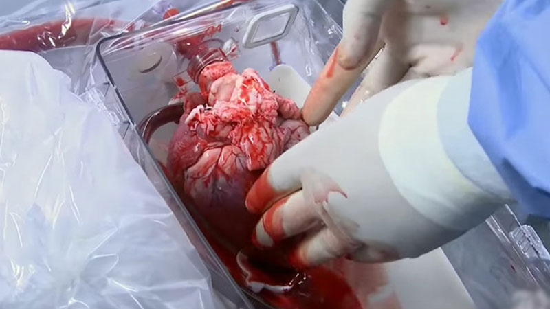 Ученые почти готовы к пересадке человеку свиного сердца