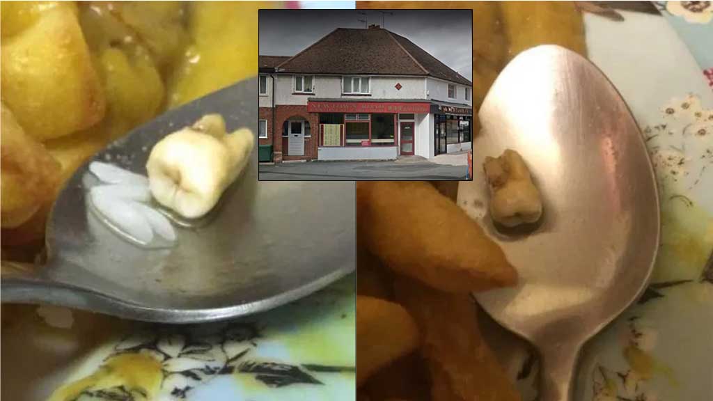 Ресторан придумал нелепое оправдание найденному в блюде человеческому зубу