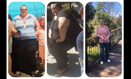 Страдающая ожирением женщина сбросила 98 кг желая жить и быть здоровой