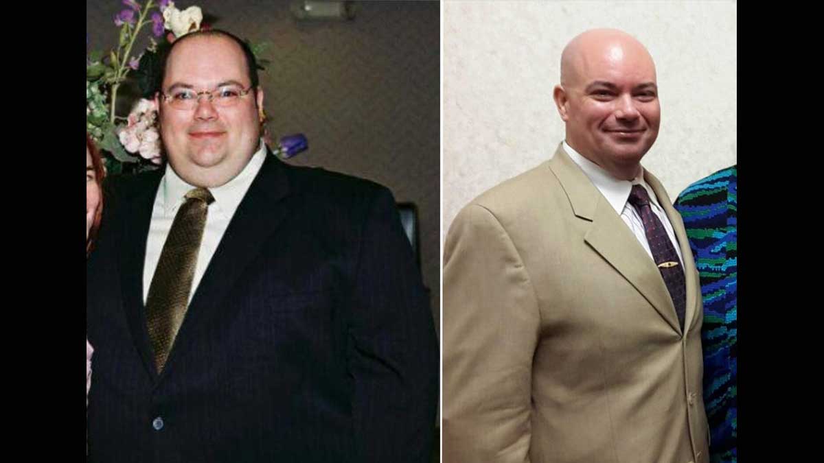 Мужчина развелся и похудел на 112 кг без диеты