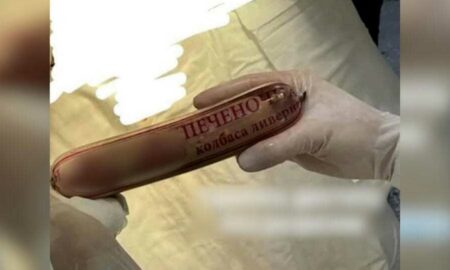 Ливерный «трофей»: врач похвастался как вытащил «без разрезов» из пациента палку колбасы