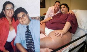 Самый толстый мужчина Британии надеется похудеть с помощью уколов